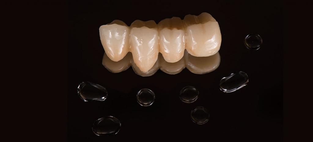 zirconia monolitica