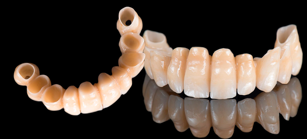 arcata in zirconia stratificata