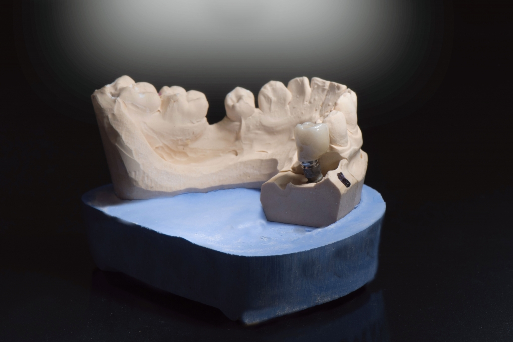 zirconia monolitica