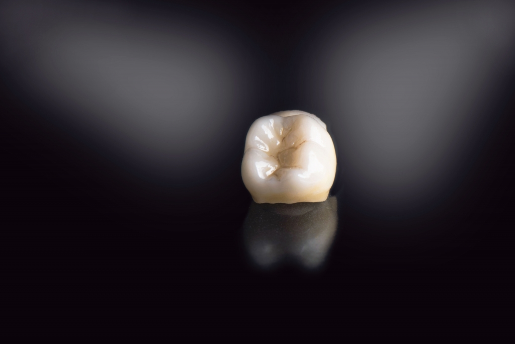 zirconia monolitica