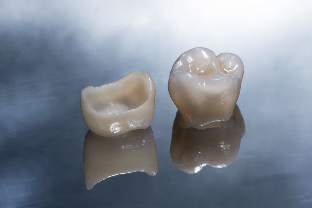 zirconia monolitica